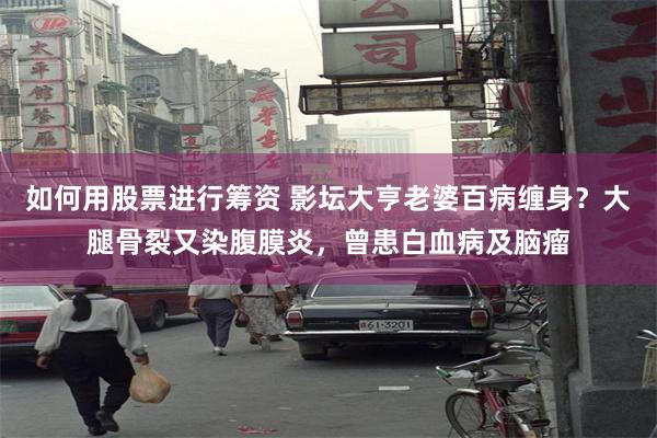 如何用股票进行筹资 影坛大亨老婆百病缠身？大腿骨裂又染腹膜炎，曾患白血病及脑瘤